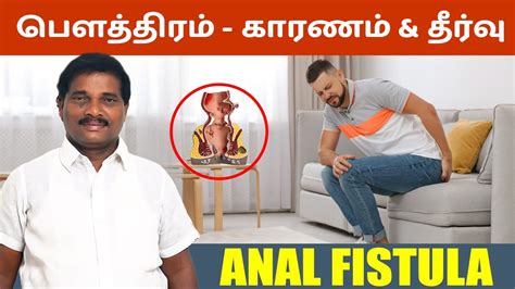பததரம கரணம தரவ Anal Fistula in tamil SAKTHI SIDDHA VAITHIYA SALAI Trichy YouTube