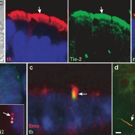 (PDF) Overview of Structure and Function of Mammalian Cilia