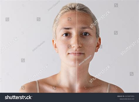 Aging Skin Process: Over 19,502 Royalty-Free Licensable Stock Photos | Shutterstock