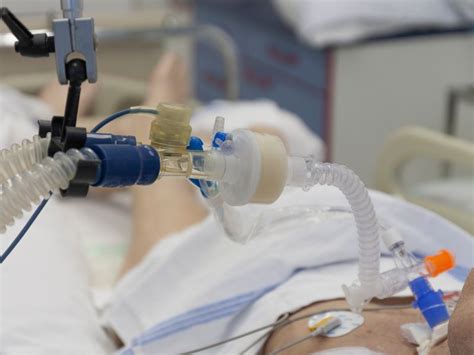 Ventilação Mecanica Invasiva - Ventilação Mecânica Invasiva com Traqueostomia: Abordagens