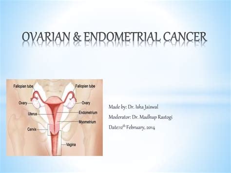 Ovarian And Endometrial Cancer Ppt