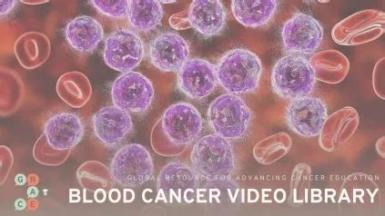 Blood Cancer Video Library - Immunotherapy Treatments for B-Cell Non ...