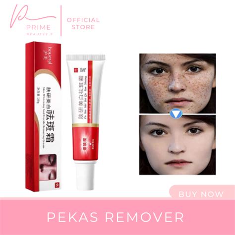 PEKAS REMOVER Effective Whitening Freckle Remover Cream Melasma