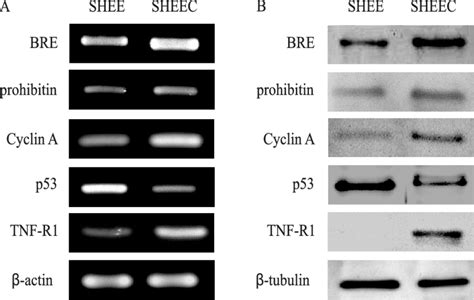 Semiquantitative Rt Pcr A And Western Blotting B Analyses Of