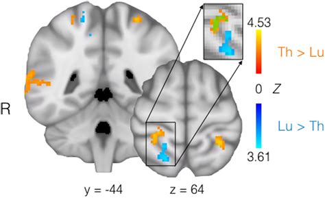 Brain regions displaying differential somatotopy, in terms of ...