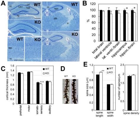 A Histological Examination Of The Hippocampus Thalamus And Cerebral