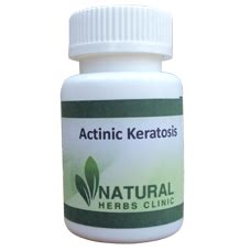 Natural Herbs Clinic - Natural Herbal Remedies For Actinic Keratosis