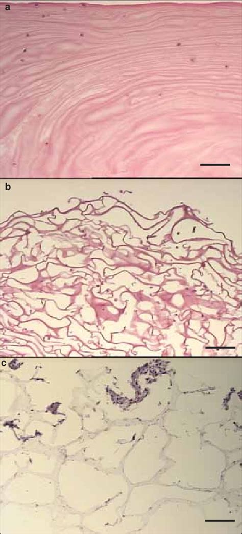 Representative Sections Of Human Chondrocyte Seeded Scaffolds At 1 Day