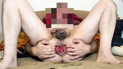 Gummi Fisting Free The Gay HD Porn Video XHamster