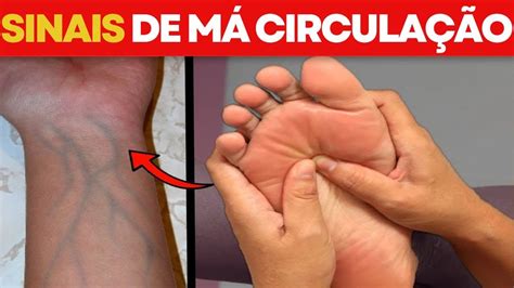 7 SINAIS QUE VOCÊ TEM MÁ CIRCULAÇÃO SANGUÍNEA sintomas de má