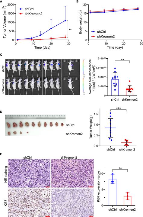 Frontiers Knockdown Of Kremen2 Inhibits Tumor Growth And Migration In