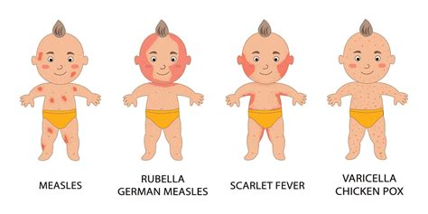 Rashes In Pediatrics Illustrated Nursing