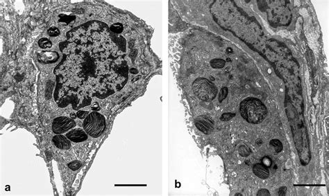 Type Ii Alveolar Epithelial Cells Aeii A Control Lung Aeii