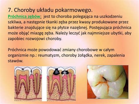 Ppt Higiena I Choroby Uk Adu Pokarmowego Powerpoint Presentation