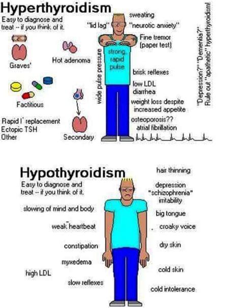 Hyperthyroidism Vs Hypothyroidism