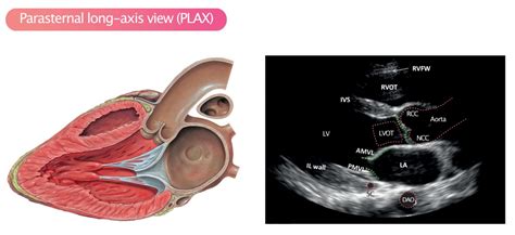 Standard Transthoracic Echocardiogram Complete Imaging Protocol