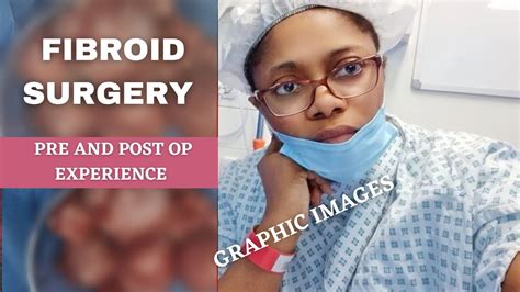 Fibroid Surgery Behind The Scene Of My Abdominal Myomectomy Recovery