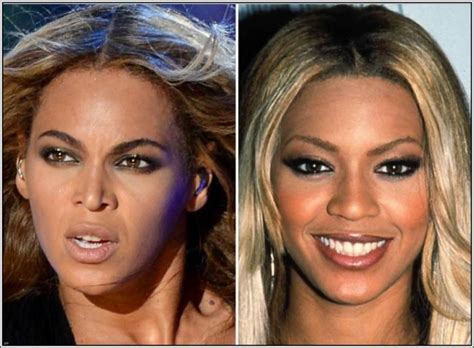 Transforming Queen Bey: A Look at Beyoncé Before and After Plastic ...