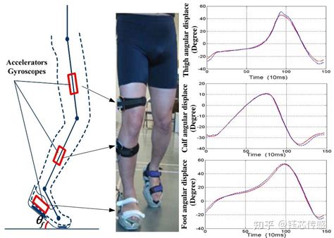 科学研究新型可穿戴传感器——通过分析步态监测健康状况 知乎