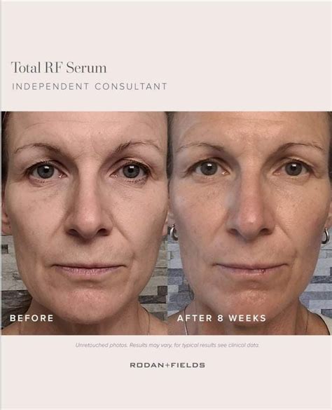 Dermatologist Inspired Skincare Products Rodan Fields® Artofit