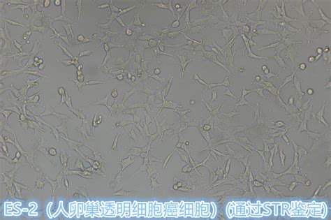 Es 2 Es 2细胞 Es 2人卵巢透明细胞癌细胞价格 详情介绍 960化工网 960化工网