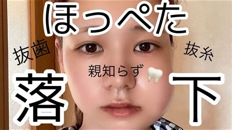 親知らず抜いたら骨まで削ることになりました Youtube