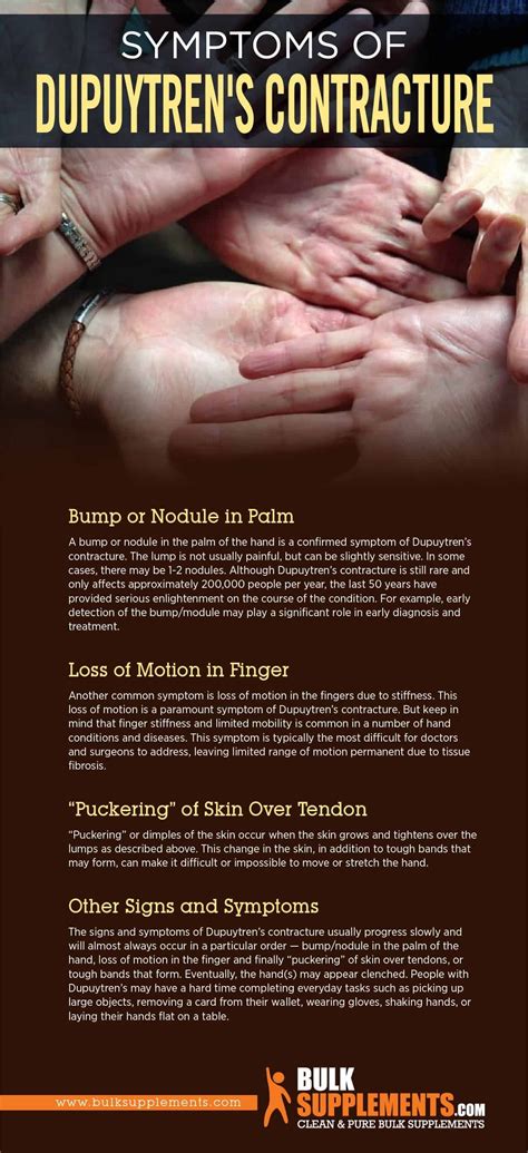 Dupuytren s contracture – Artofit