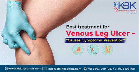 Venous Leg Ulcers Its Causes Symptoms Prevention And Treatment