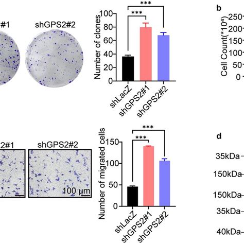 GPS2 Knockdown Promoted UM Progression In BALB C Nude Mice Western