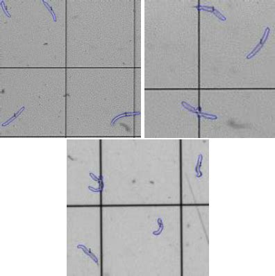 Examples of nematodes detected by the proposed approach. | Download ...