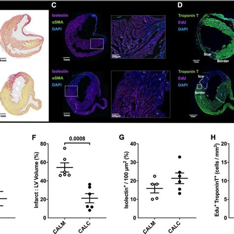 Immunohistochemical Assessment Of Mature Infarct Area And Myocardial