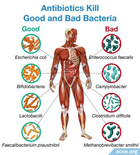 Are Antibiotics A Good Idea For The Treatment Of Acne Acne Org