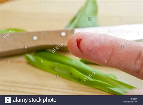 Laceration High Resolution Stock Photography and Images - Alamy