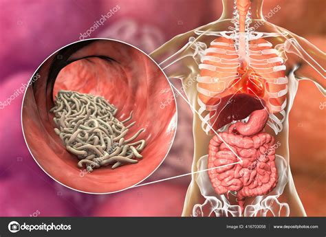 Parasitic Worms Lumen Intestine Illustration Ascaris 56 Off