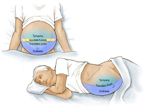 Pin on Gastenterology