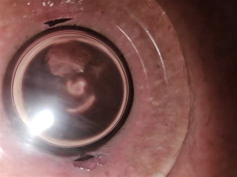 Anal Dilation And Destruction Pics XHamster