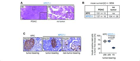 Altered Pancreas Morphology And Reduced Percentage Of Insulin