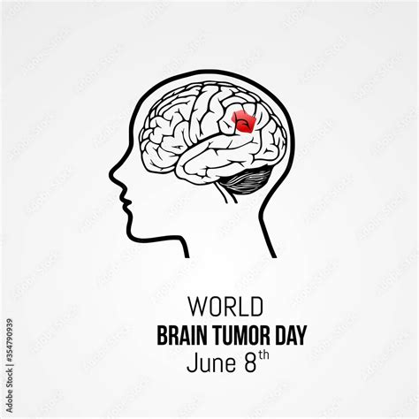 World Brain Tumor Day Vector Illustration Stock Vector | Adobe Stock