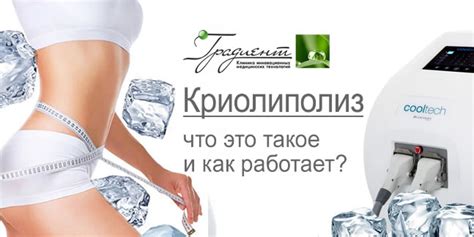 Криолиполиз – что это такое и как работает?