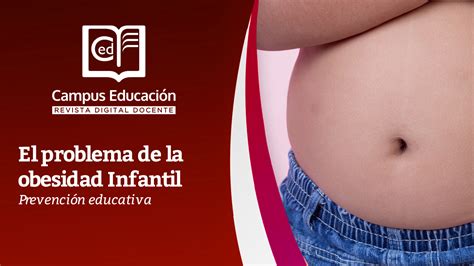 El Problema De La Obesidad Infantil