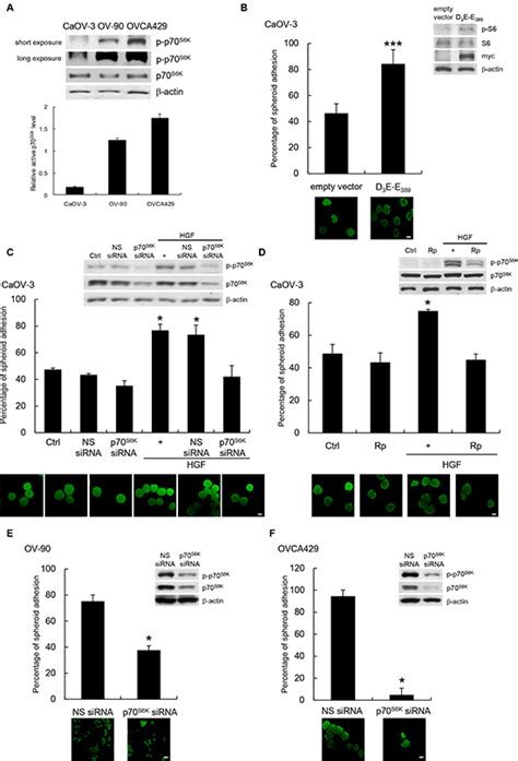 p70 S6 kinase drives ovarian cancer metastasis through multicellular ... 
