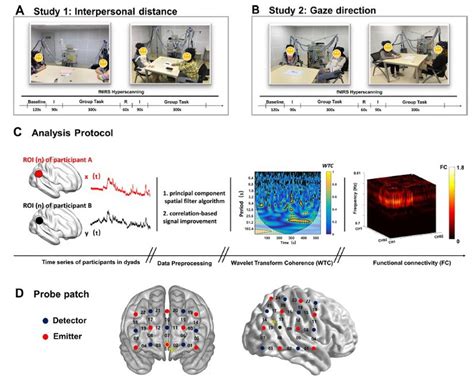 Neuroimage