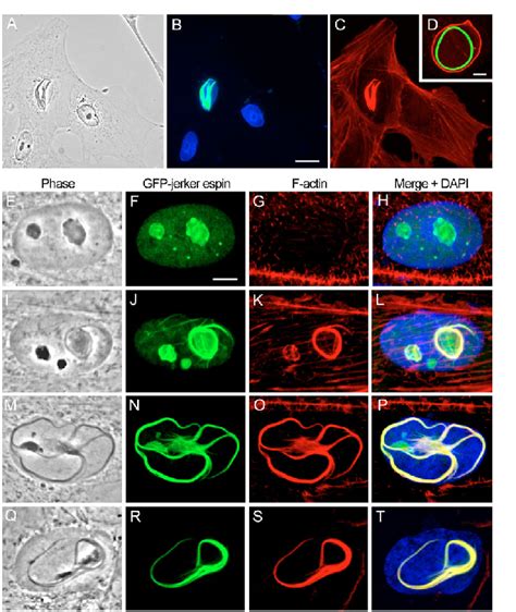 Formation Of Nuclear Actin Bundle NAB In LLC PK1 Cells Transfected