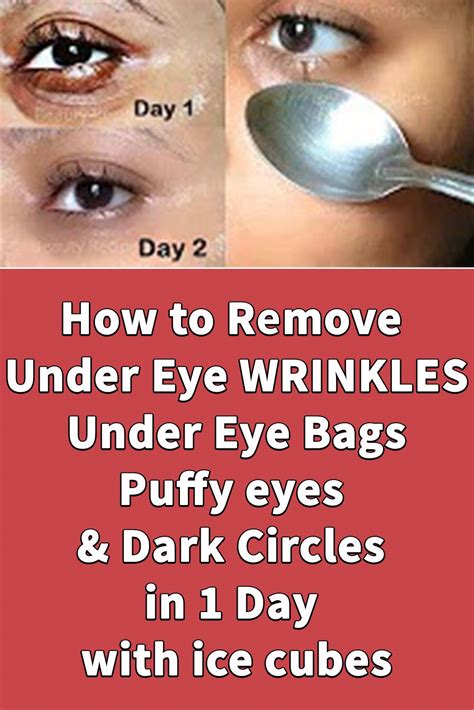 How To Remove Under Eye Wrinkles Under Eye Bags Puffy Eyes And Dark