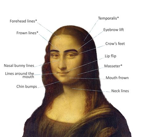 Botox® - Seattle Smiles Dental