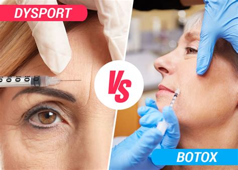 Dysport Vs Botox Best Difference