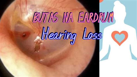 BUTAS NA EARDRUM JOURNEY YouTube