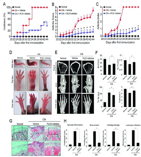 The Pld Inhibitor Ameliorates Arthritis And Bone Erosion In