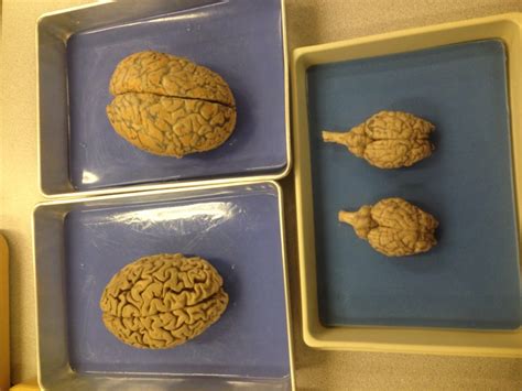 Human Brain Vs Sheep Brain In My Lab Yesterday Pics