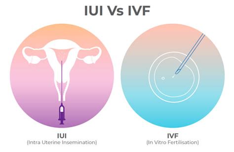 IUI Procedure How Does IUI Work Step By Step Dr Namita